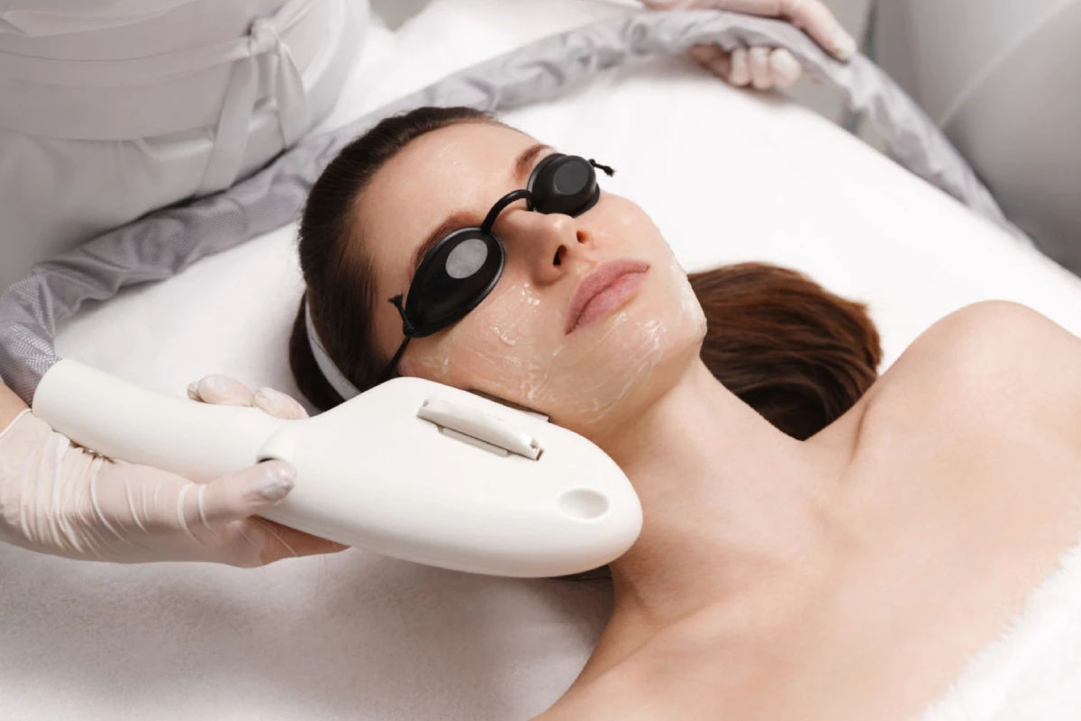 Photofacial Treatment in Mesa, AZ | Emily Frost Aesthetics