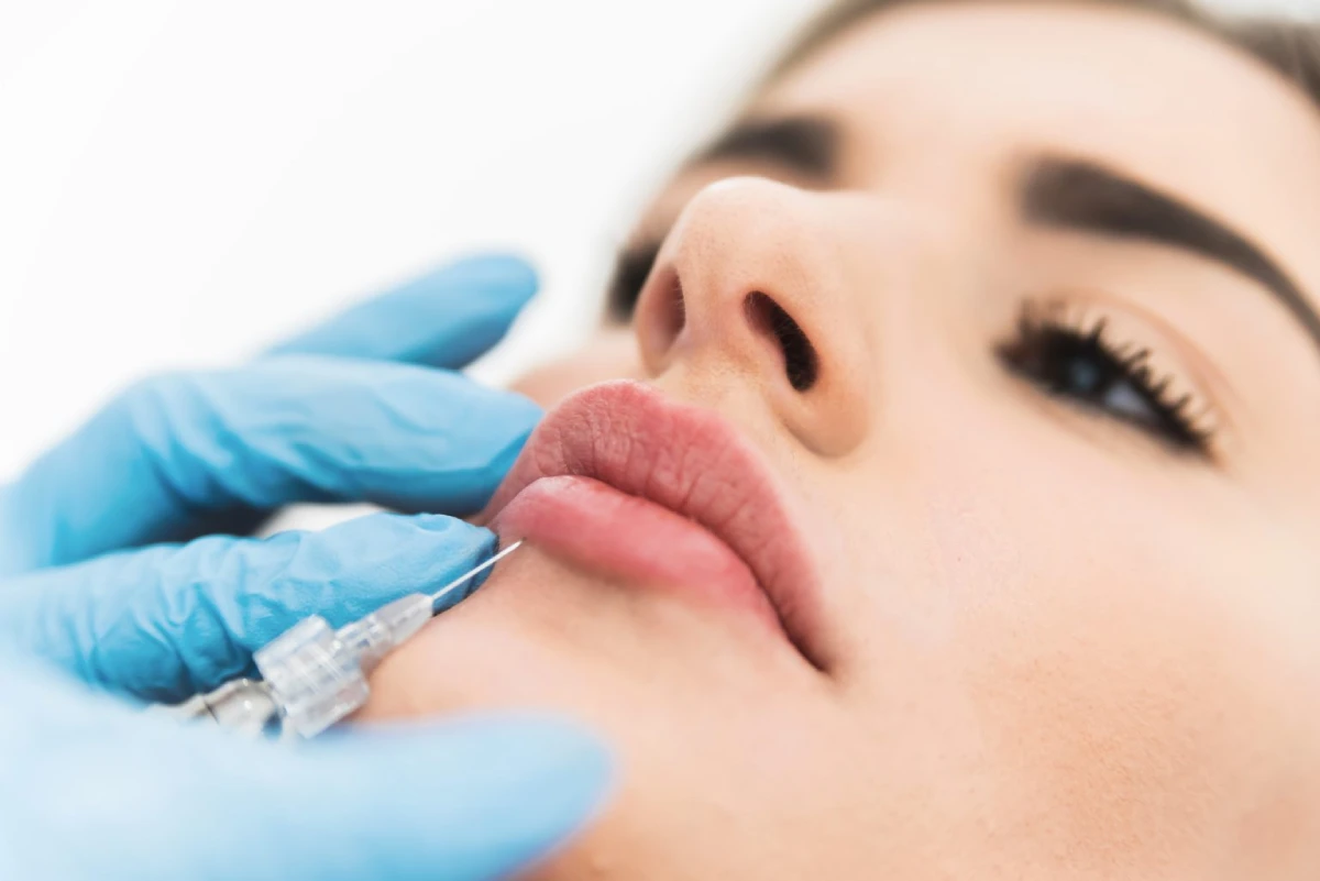 Shaping lips with fillers are lip fillers painful in Mesa, AZ | Emily Frost Aesthetics