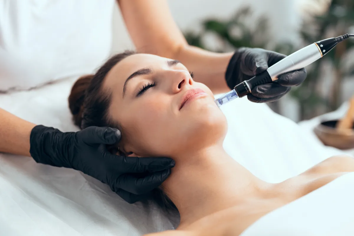 A Woman Getting Moxi MicroneedlingTreatment in Mesa, AZ | Emily Frost Aesthetics