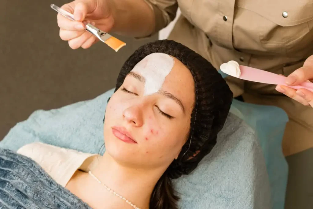 Emily Frost Aesthetics Acne Facial in Mesa, AZ