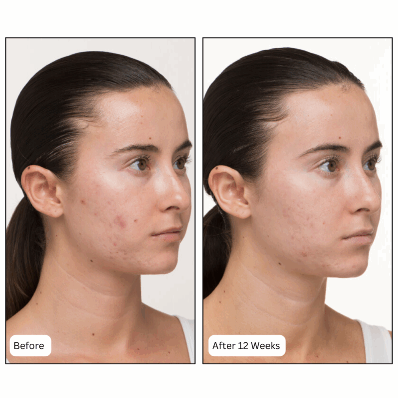 Nutrafol Skin - Image 3
