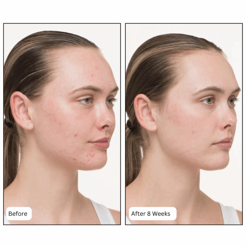 Nutrafol Skin - Image 2