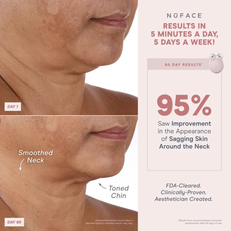 NuFACE MINI + Smart Facial Device Kit - Image 4
