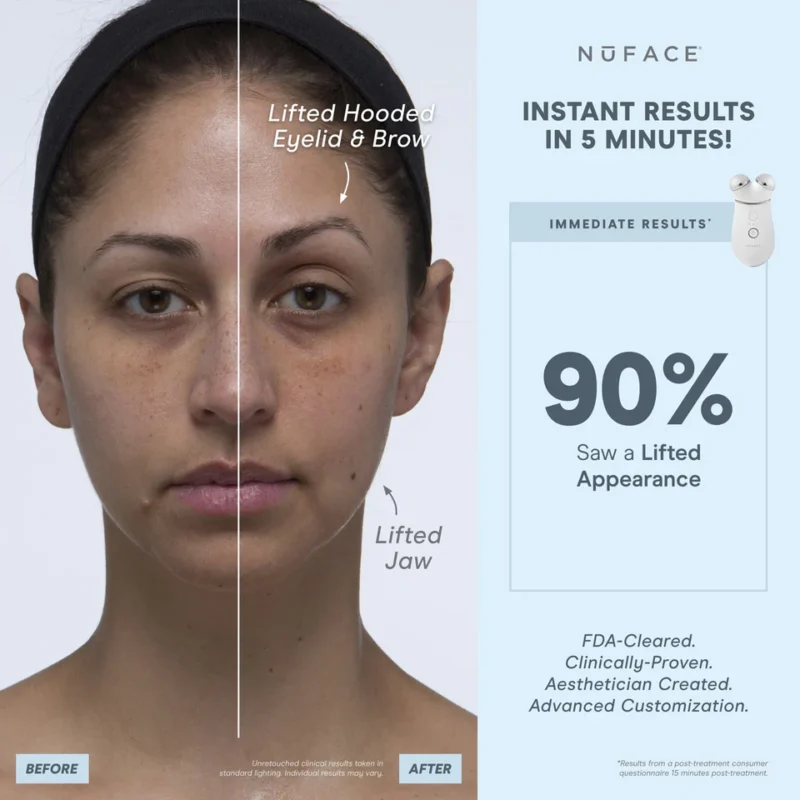 NuFACE TRINITY+ Smart Advanced Facial Microcurrent Device Kit - Image 3
