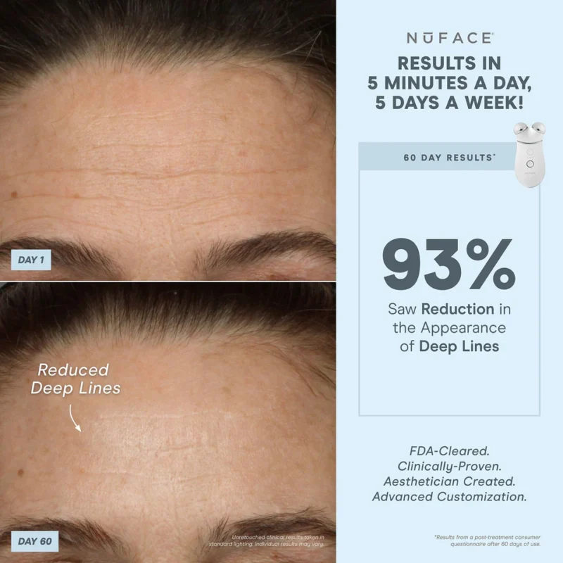 NuFACE TRINITY+ Smart Advanced Facial Microcurrent Device Kit - Image 5