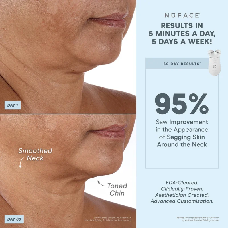 NuFACE TRINITY+ Smart Advanced Facial Microcurrent Device Kit - Image 4