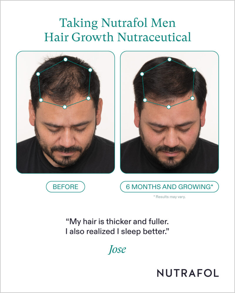 Nutrafol Men - Image 3