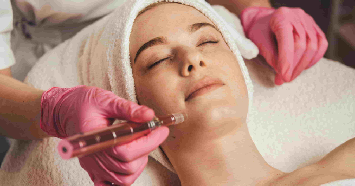 A close-up of a person with red gloves using a microneedling treatment on a woman's forehead in Mesa, AZ