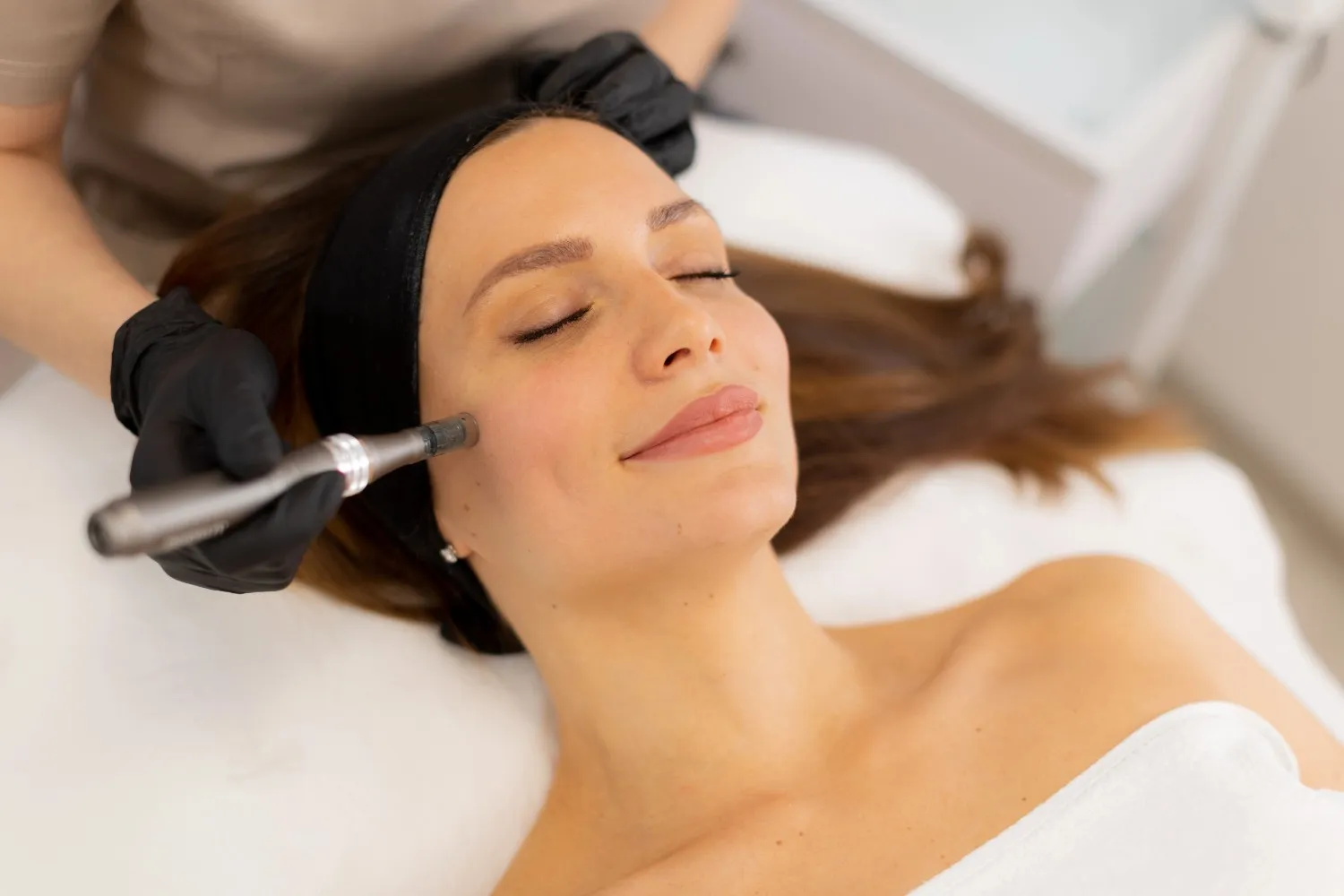 Microneedling Benefits